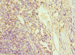 CSB-PA009939ESR2HU