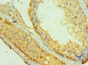 CSB-PA013323ESR2HU