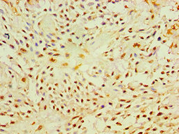 CSB-PA017340ESR2HU