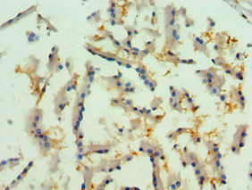 CSB-PA019736ESR1HU