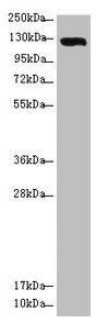 CSB-PA850427ESR2HU