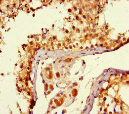 CSB-PA008968HA01HU