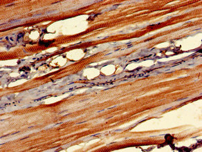 CSB-PA857869LA01HU