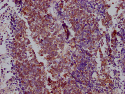 CSB-RA181189A0HU