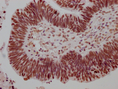 CSB-RA279005A0HU