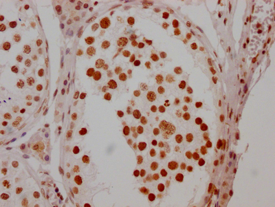 CSB-RA279005A0HU