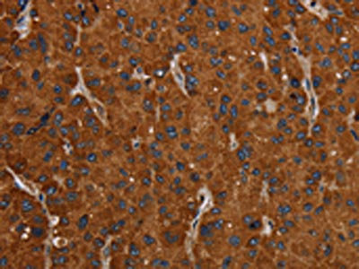 CSB-PA041473