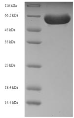 CSB-EP019736HU