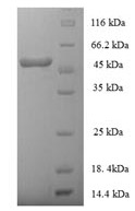 CSB-EP320269HU DS-PAGE