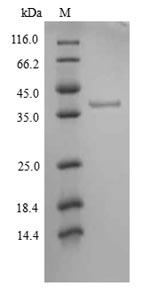 CSB-YP011930HU