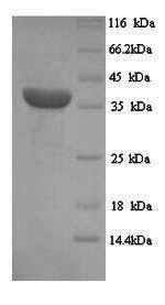CSB-YP013323HU